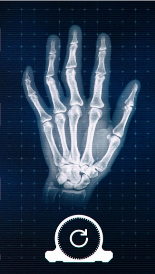 真实X射线模拟器