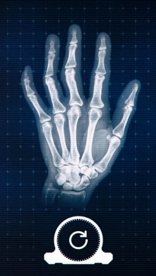 真实X射线模拟器