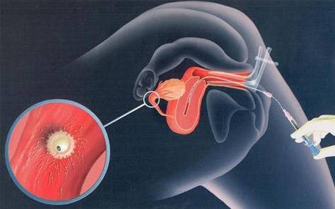 精子在线观看视频国产全新版本复活,平台:解除使用限制! 精子在线观看视频国产全新版本复活,平台:解除使用限制!