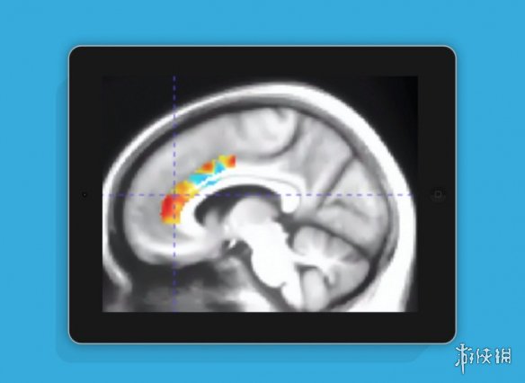 美国最新的科研发现表明，特定类型的认知训练游戏能够显著延缓老年人认知能力的衰退进程
