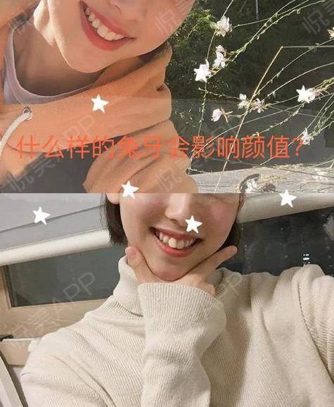 兔牙视频深夜释放自己人