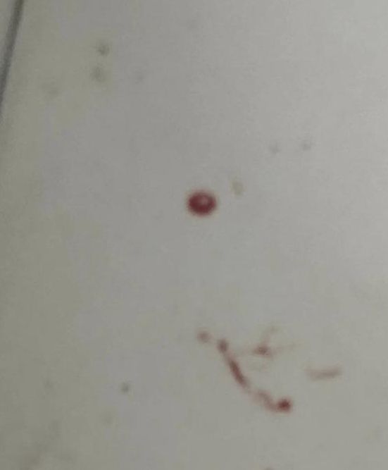 处破流血疼哭在线观看