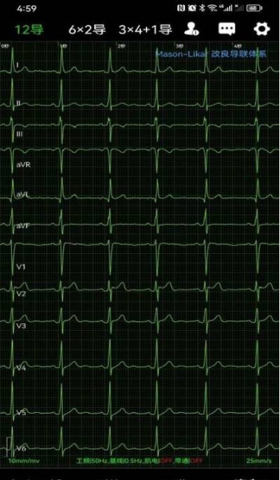 心电一张网官网版