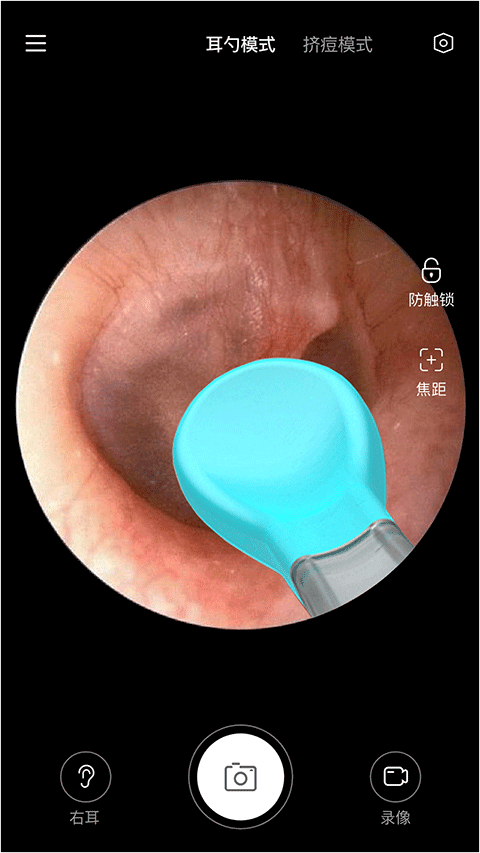 Xlife掏耳勺手机版